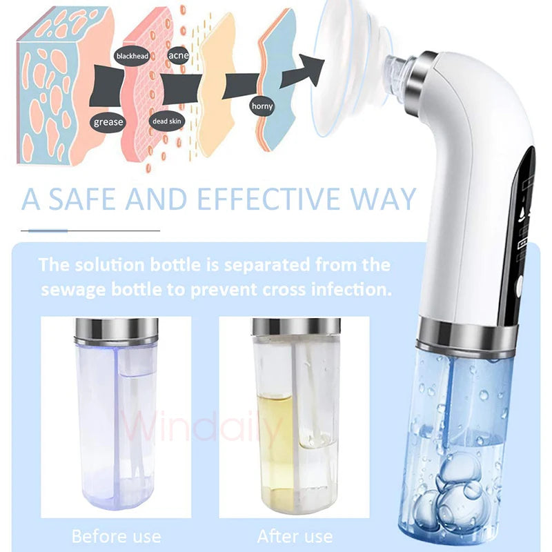 2025 Blackhead Remover Pore Vacuum Cleaner Electric Micro Small Bubble Facial Cleasing Machine USB Rechargeable Beauty Device